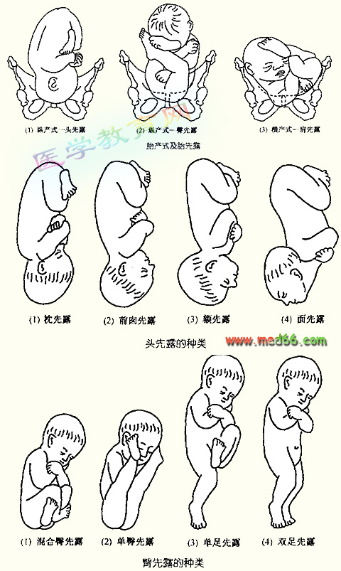 (06.09)---第三杯 《临床执业/助理医师-妇产科-胎方位》