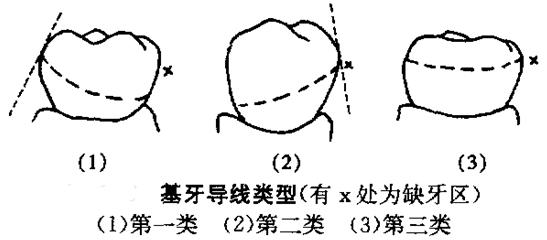 口腔执业口腔执业助理医师修复学易混淆内容大集合经验分享